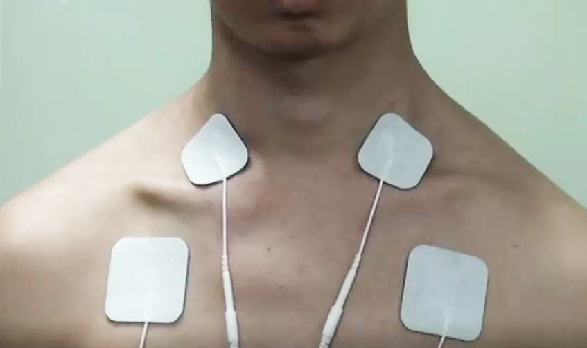 如何选择合适的无纺布水凝胶理疗电极片?